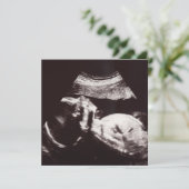 Persoonlijk Ultrasound Afbeelding Baby shower Kaart (Staand voorkant)