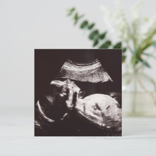 Persoonlijk Ultrasound Afbeelding Baby shower Kaart (Staand voorkant)