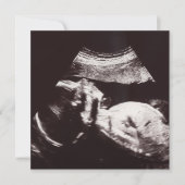 Persoonlijk Ultrasound Afbeelding Baby shower Kaart (Voorkant)