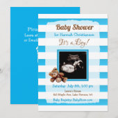 Persoonlijk Ultrasound Afbeelding Baby shower Kaart (Voorkant / Achterkant)