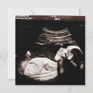 Persoonlijk Ultrasound Afbeelding Baby shower Kaart