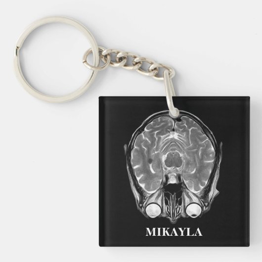 Persoonlijke MRI Brain Scan Sleutelhanger (voorkant)