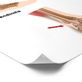 Pijn aan de voet Problemen met de achillespees Pos Poster (Hoek)