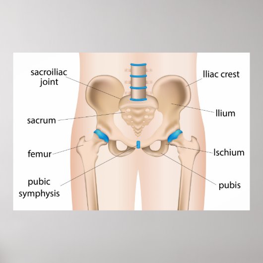 Pijn in de heup bursitis poster (Voorkant)