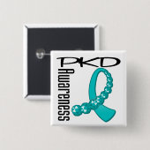 PKD Awareness Gemstone Ribbon Vierkante Button 5,1 Cm (Voorkant /achterkant)