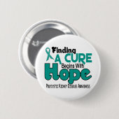 PKD Polycysteus Nierziekte HOPE 5 Ronde Button 5,7 Cm (Voorkant /achterkant)