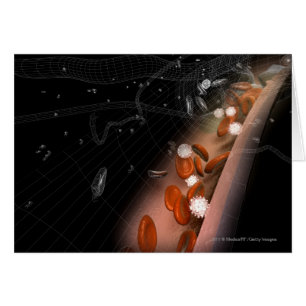 Plaque in de slagaders