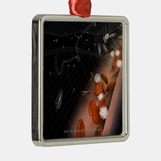 Plaque in de slagaders metalen ornament (Rechts)