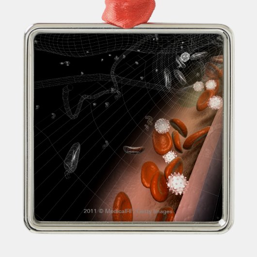 Plaque in de slagaders metalen ornament (Voorkant)