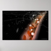 Plaque in de slagaders poster (Voorkant)