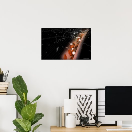 Plaque in de slagaders poster (Thuiskantoor)