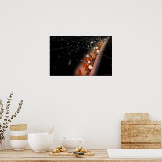 Plaque in de slagaders poster (Keuken)