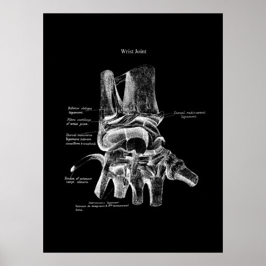 Polst Anatomy Medical Poster Orthopedisch Decor (Voorkant)