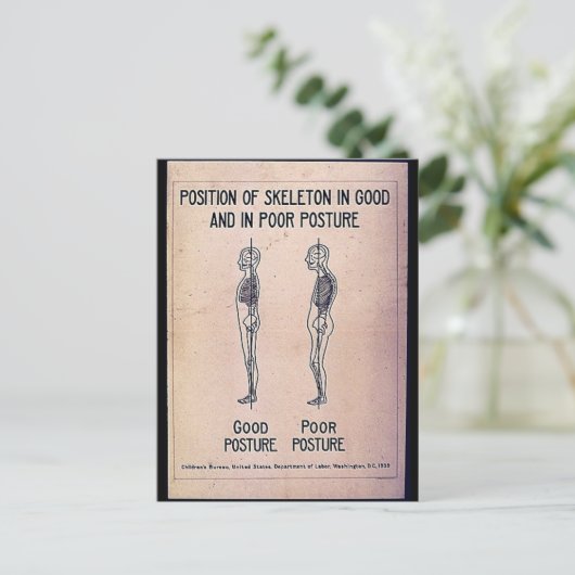 Positie van het skelet in goede en slechte toestan briefkaart (Staand voorkant)