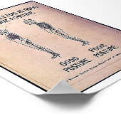 Positie van het skelet in goede en slechte toestan poster (Hoek)