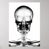 POSTER/AFDRUKKEN X-RAY VISION SKELETON SKULL - B&W POSTER (Voorkant)