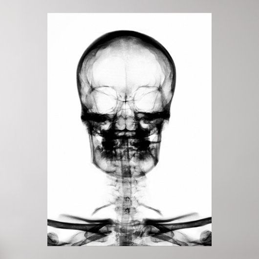 POSTER/AFDRUKKEN X-RAY VISION SKELETON SKULL - B&W POSTER (Voorkant)