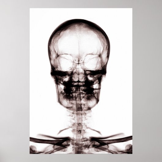 POSTER/AFDRUKKEN X-RAY VISION SKELETON SKULL ORIG/ POSTER (Voorkant)