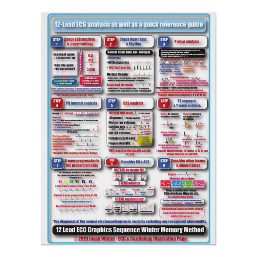 POSTER ECG-training (Voorkant)