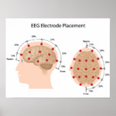 POSTER EEG-elektrodeplaatsingsdiagram (Voorkant)
