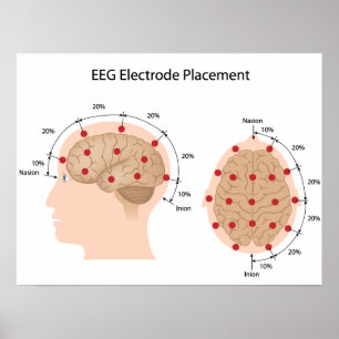 POSTER EEG-elektrodeplaatsingsdiagram