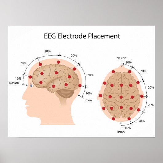 POSTER EEG-elektrodeplaatsingsdiagram (Voorkant)