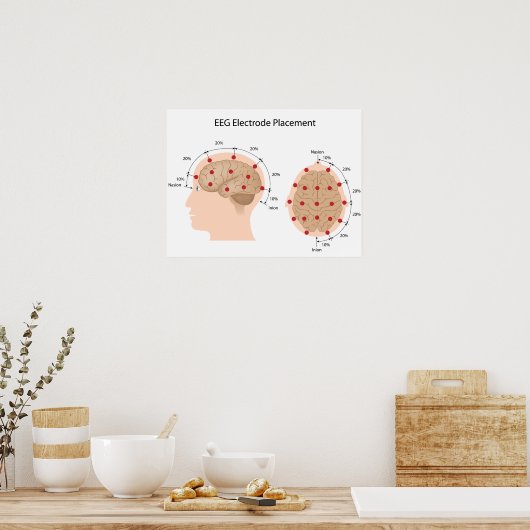 POSTER EEG-elektrodeplaatsingsdiagram (Keuken)