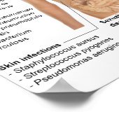 Poster Grafiek van bacteriële infecties bij de men (Hoek)