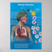 Poster met allergische reactie (Voorkant)