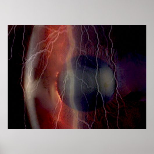 Poster met bliksem boven een gescheurde cornea (Voorkant)