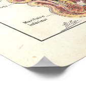 Poster met neus en sinussen voor anatomie in het F (Hoek)