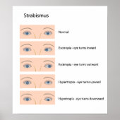 Poster met strabismus-oogdefect (Voorkant)