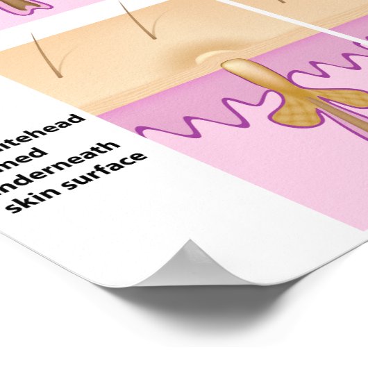 Poster met zwarte kop (Hoek)