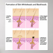 Poster met zwarte kop (Voorkant)