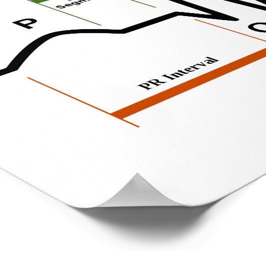 Poster Sinus Rhythm ECG Figuur (Hoek)