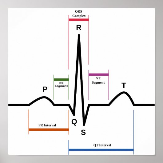 Poster Sinus Rhythm ECG Figuur (Voorkant)