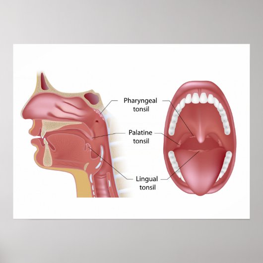 Poster tonsils (Voorkant)