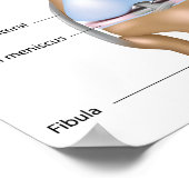 Poster van anatomie van menselijke kniegewrichten (Hoek)