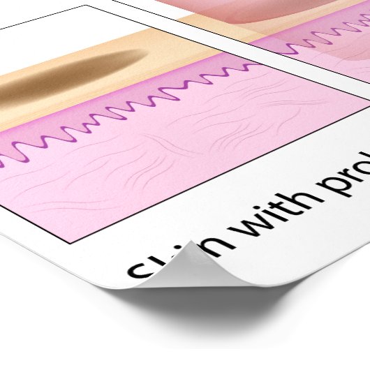Poster van de laserhuidherurbietprocedure (Hoek)