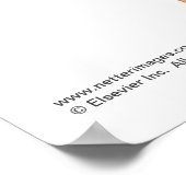 Poster van de spieren aan de voorzijde van de buik (Hoek)