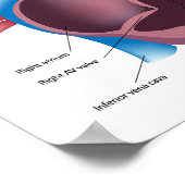 Poster van het menselijk hart (Hoek)