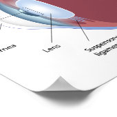 Poster van het oogretinaire loslaten (Hoek)