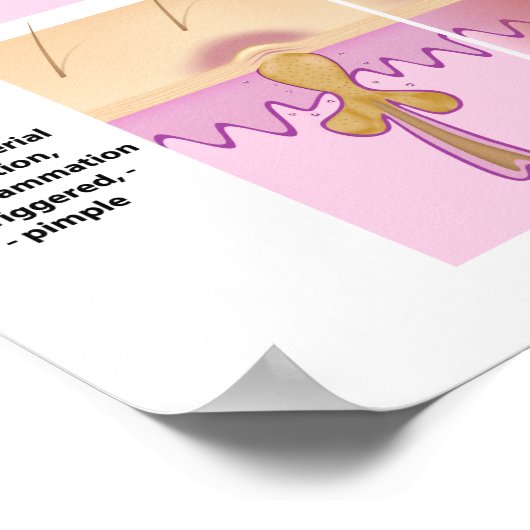 Poster van huidacne en puistjes (Hoek)