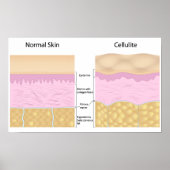 Poster van huidcellulose (Voorkant)
