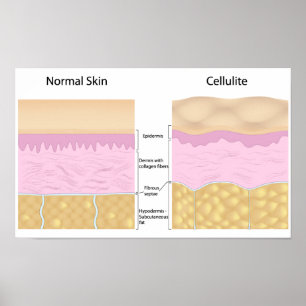 Poster van huidcellulose