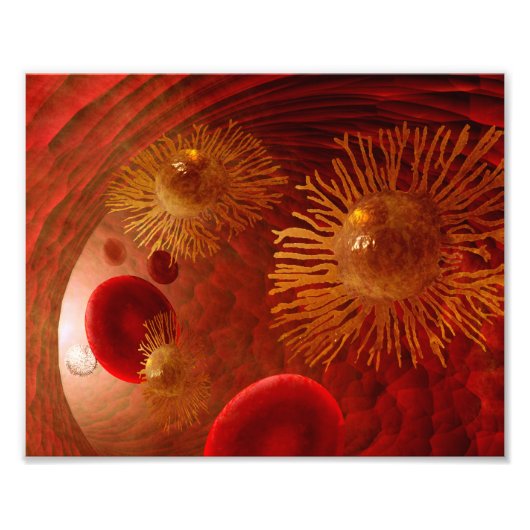 Poster van kankergemetastaseerde (Voorkant)