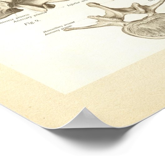 Poster van wervelkolom en wervels (Hoek)