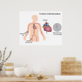 Poster voor cardiale catheterisatie (Keuken)