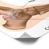Poster voor het indelen van zijdelingse enkels (Hoek)