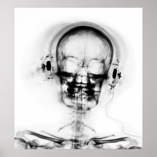 POSTER - X-RAY MUSIC SKELETON BLACK GRAY B&W (Voorkant)